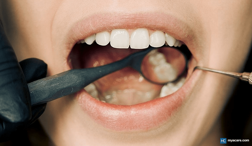 The effect of systemic drugs on the mouth